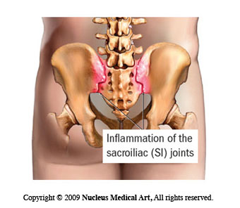 下背痛｜下背痛問題原因可能不只腰，還有……｜晉熯脊骨物理治療所