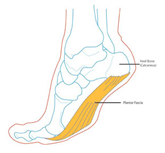 足底筋膜炎｜一個症狀產生的根源點往往意想不到｜晉熯脊骨物理治療所