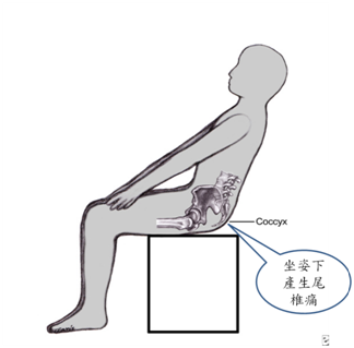 全身拉筋｜尾椎痛真的就是尾椎的問題嗎｜晉熯脊骨物理治療所