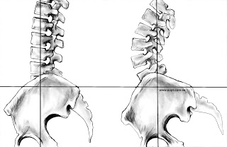 骨盆矯正運動｜腰酸背痛好不了，原來是骨盆控制出了問題…｜晉熯脊骨物理治療所
