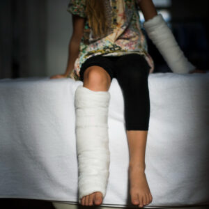 骨折後復健可以在家做嗎？什麼情況要到診所