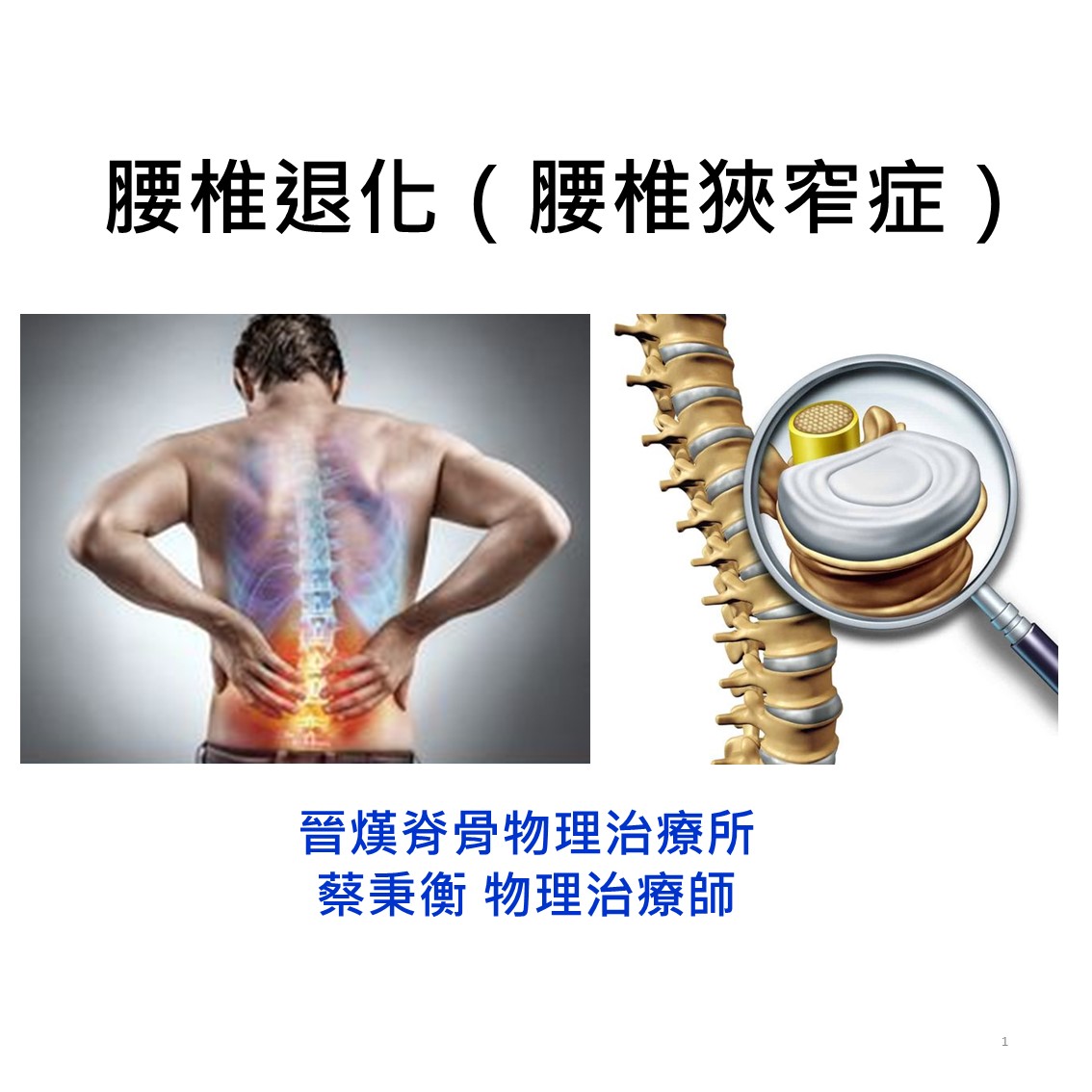 下背痛｜腰椎退化( 腰椎狹窄症 )｜晉熯脊骨物理治療所